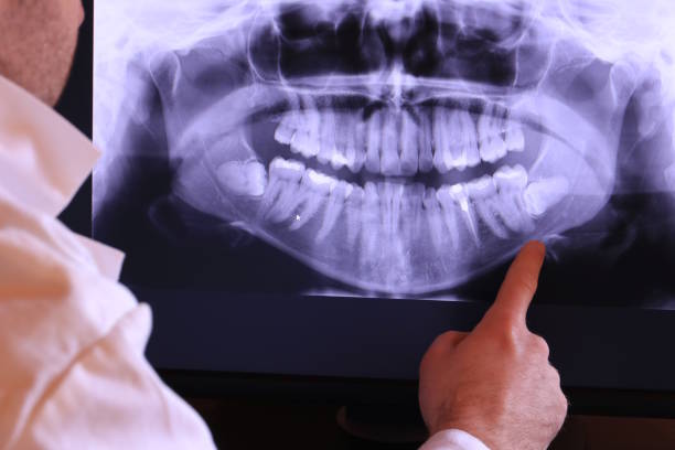 Best Emergency Wisdom Tooth Extraction in Early, TX